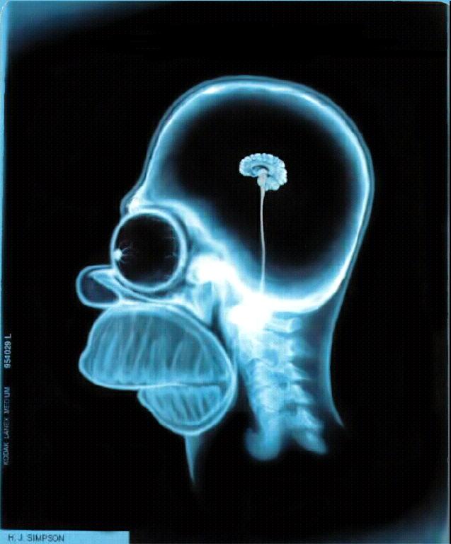 Homer Simpsons X-Ray!